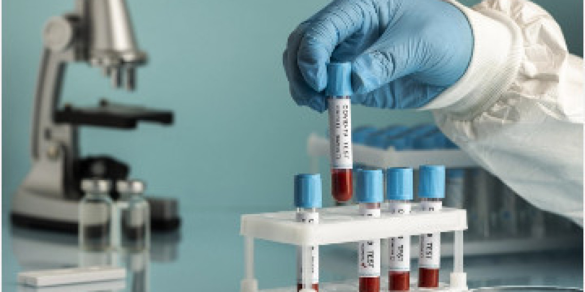 LFT Test Price in Lahore: Complete Guide to Liver Function Testing, Benefits, and Preparation